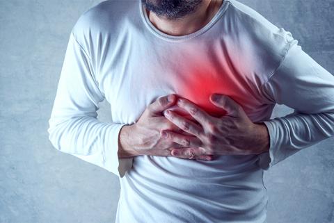 النوبة القلبية: ما هي؟ وما هي أعراض الإصابة بها؟